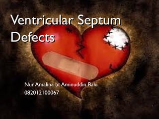 Ventricular SeptumVentricular Septum
DefectsDefects
Nur Amalina bt Aminuddin Baki
082012100067
 