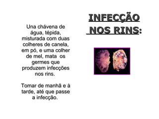INFECÇÃO
  Una chávena de
   água, tépida,       NOS RINS:
misturada com duas
colheres de canela,
em pó, e uma colher
  de mel, mata os
    germes que
produzem infecções
     nos rins.

Tomar de manhã e à
tarde, até que passe
     a infecção.
 