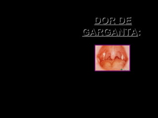 Tome, a cada
quatro horas,
uma colher
de mel
misturada
com 1/2 de
vinagre
de maçã.
DOR DEDOR DE
GARGANTAGARGANTA::
 