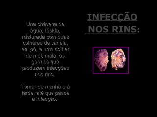 Una chávena deUna chávena de
água, tépida,água, tépida,
misturada com duasmisturada com duas
colheres de canela,colheres de canela,
em pó, e uma colherem pó, e uma colher
de mel, mata osde mel, mata os
germes quegermes que
produzem infecçõesproduzem infecções
nos rins.nos rins.
Tomar de manhã e àTomar de manhã e à
tarde, até que passetarde, até que passe
a infecção.a infecção.
INFECÇÃOINFECÇÃO
NOS RINSNOS RINS::
 