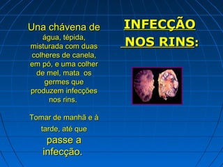 Una chávena de        INFECÇÃO
   água, tépida,
misturada com duas    NOS RINS:
colheres de canela,
em pó, e uma colher
  de mel, mata os
    germes que
produzem infecções
     nos rins.

Tomar de manhã e à
  tarde, até que
    passe a
   infecção.
 
