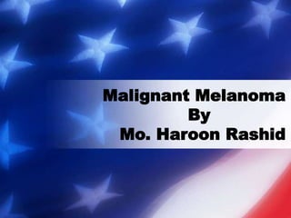 Malignant Melanoma
By
Mo. Haroon Rashid
 