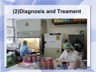 (2)Diagnosis and Treament 
 