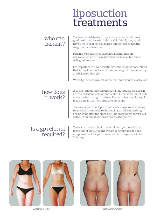 Weight loss sherman oaks picture 5