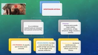 HIPERTENSIÓN ARTERIAL
Es un síndrome
caracterizado por elevación
de la presión arterial (HTA).
HTA PRIMARIA: Es aquella
que no tiene causa
conocida
HTA SECUNDARIA: Se debe
a una anomalía que se
puede corregir que pueden
ser de origen renal,
vascular, endocrino, etc.
Síntomas: No suele tener
síntomas pero puede
haber cefalea,
somnolencia, vértigo,
cansancio, fatiga, nauseas y
vómitos
Consecuencias: Accidente
cerebrovascular,
insuficiencia cardiaca e
infarto, lesión en los
riñones
 