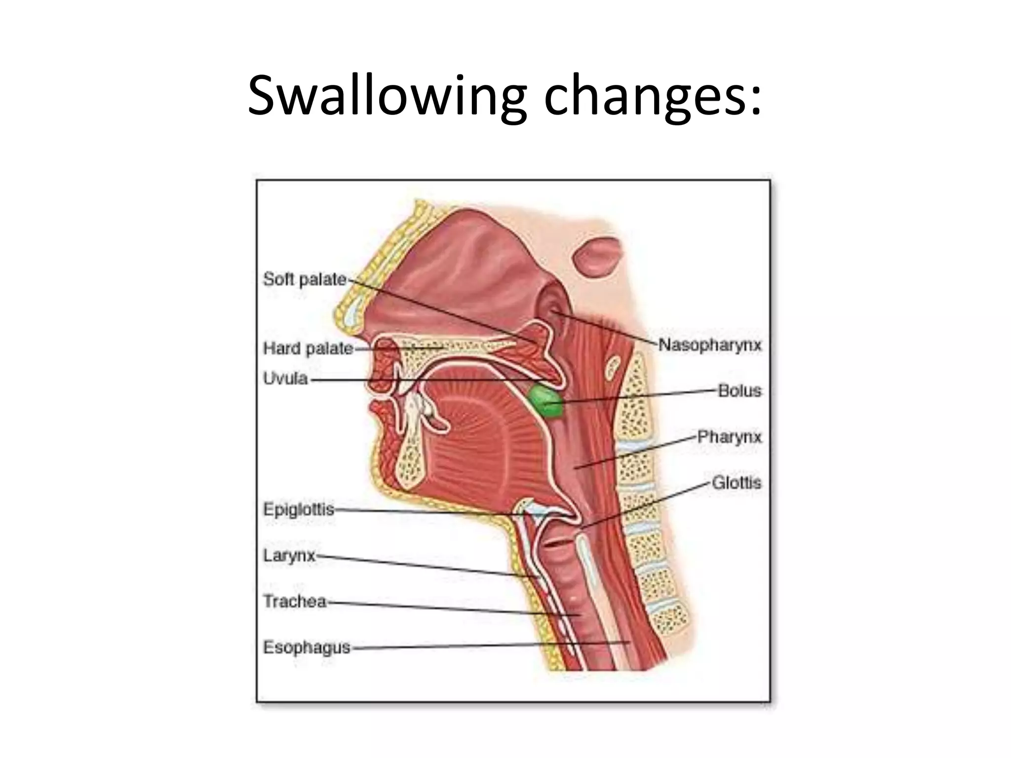Swallowing changes:
 