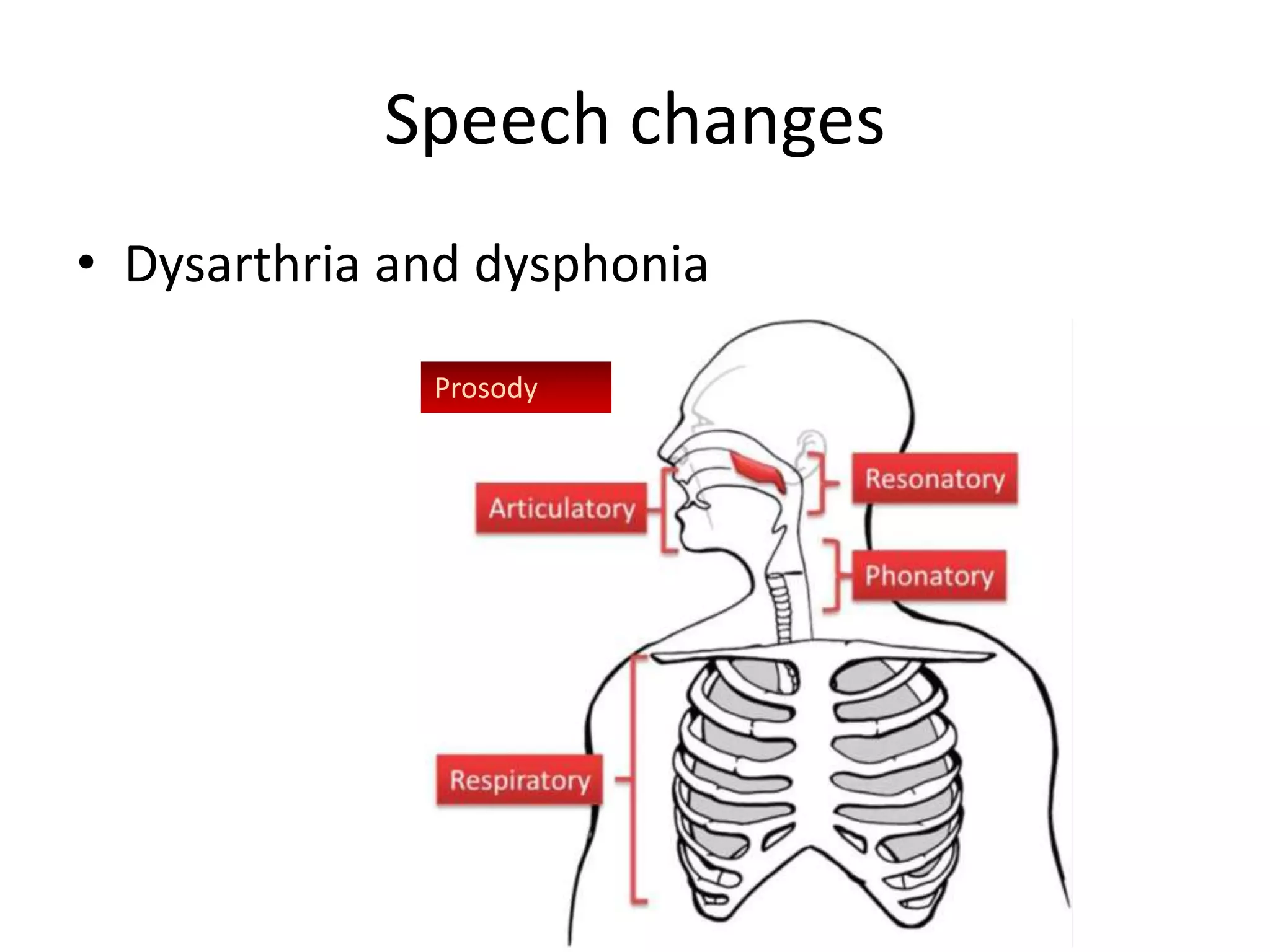 Speech changes
• Dysarthria and dysphonia
Prosody
 