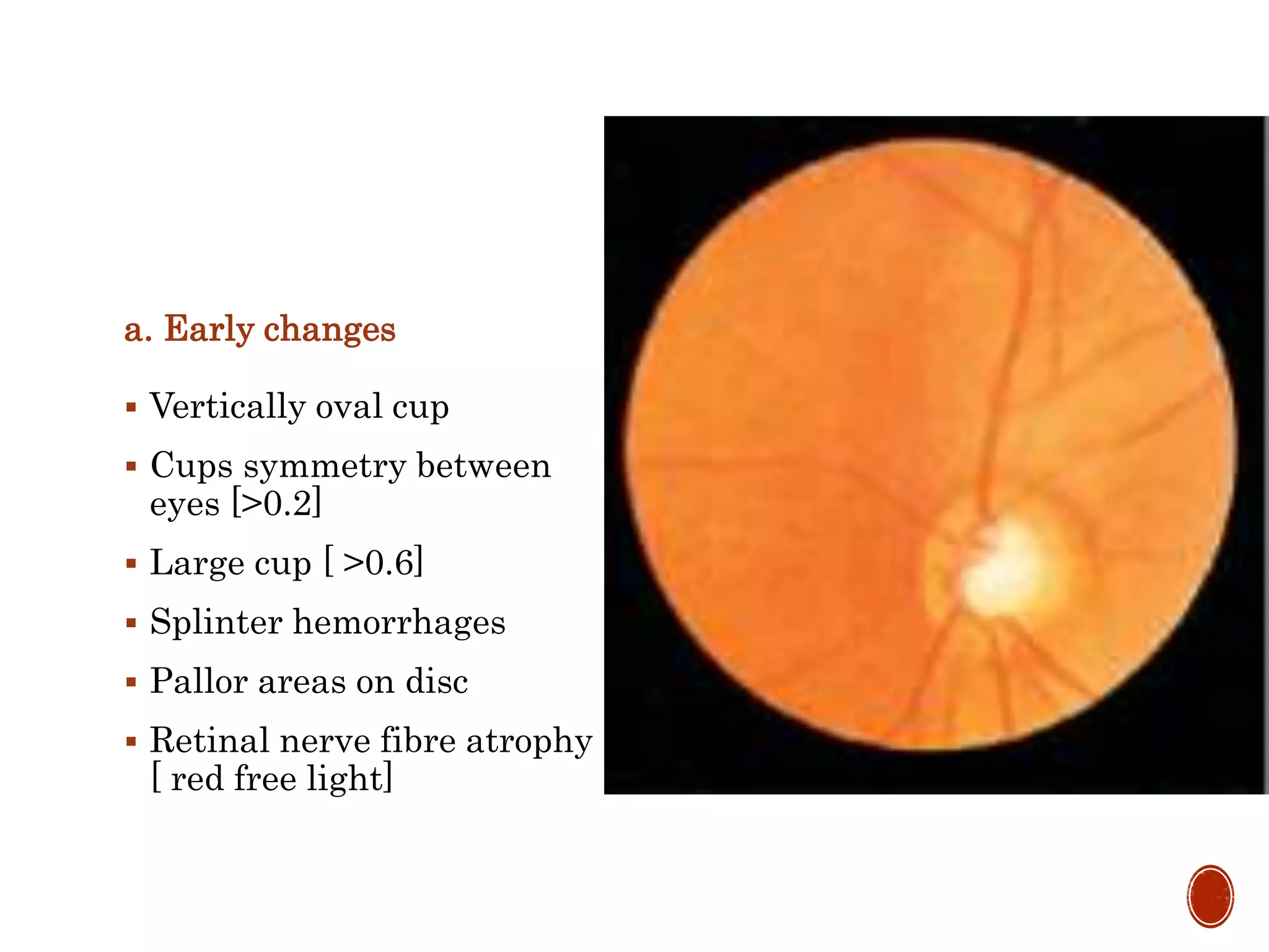 a. Early changes
 Vertically oval cup
 Cups symmetry between
eyes [>0.2]
 Large cup [ >0.6]
 Splinter hemorrhages
 Pallor areas on disc
 Retinal nerve fibre atrophy
[ red free light]
 