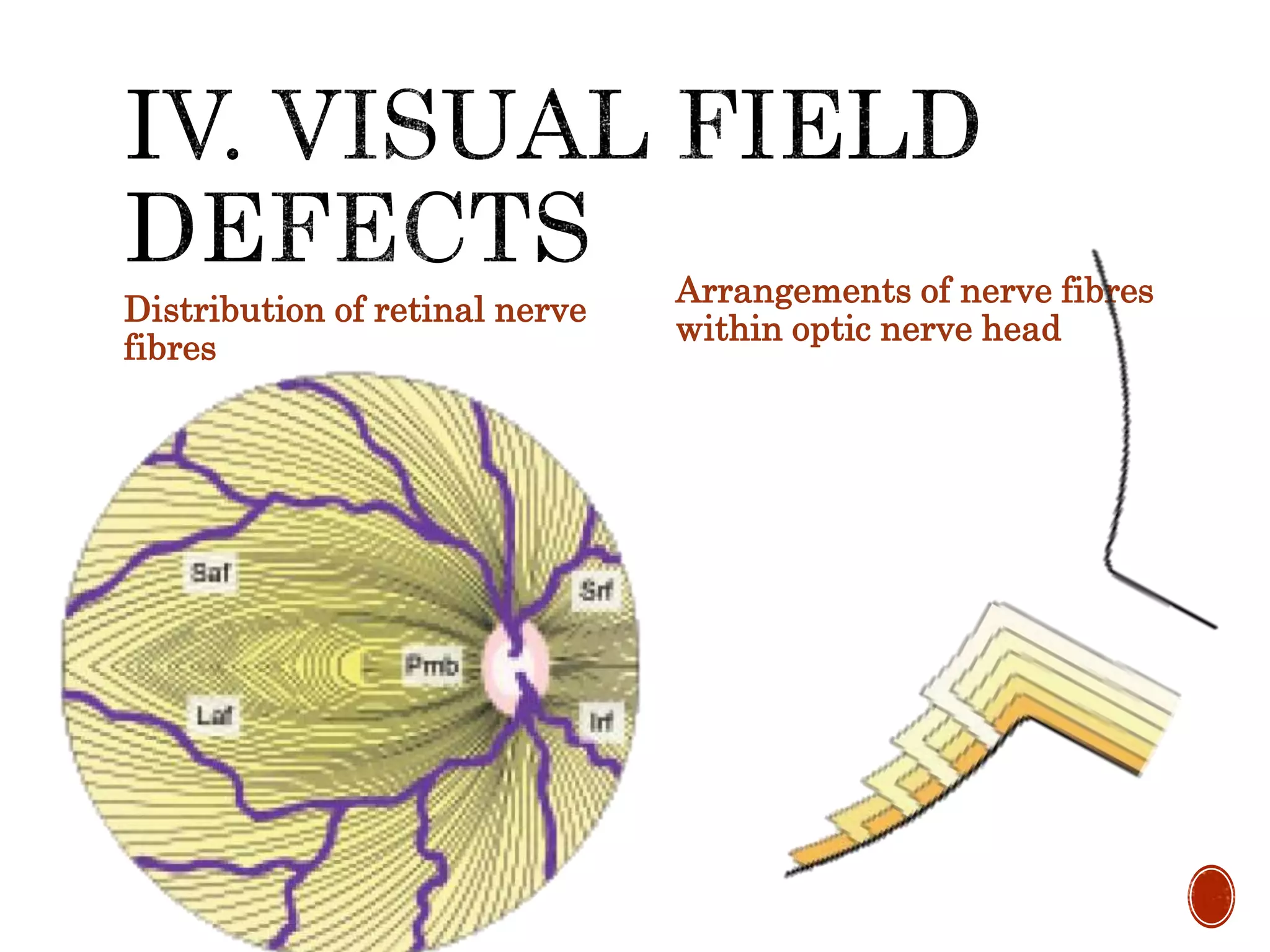 Distribution of retinal nerve
fibres
Arrangements of nerve fibres
within optic nerve head
 