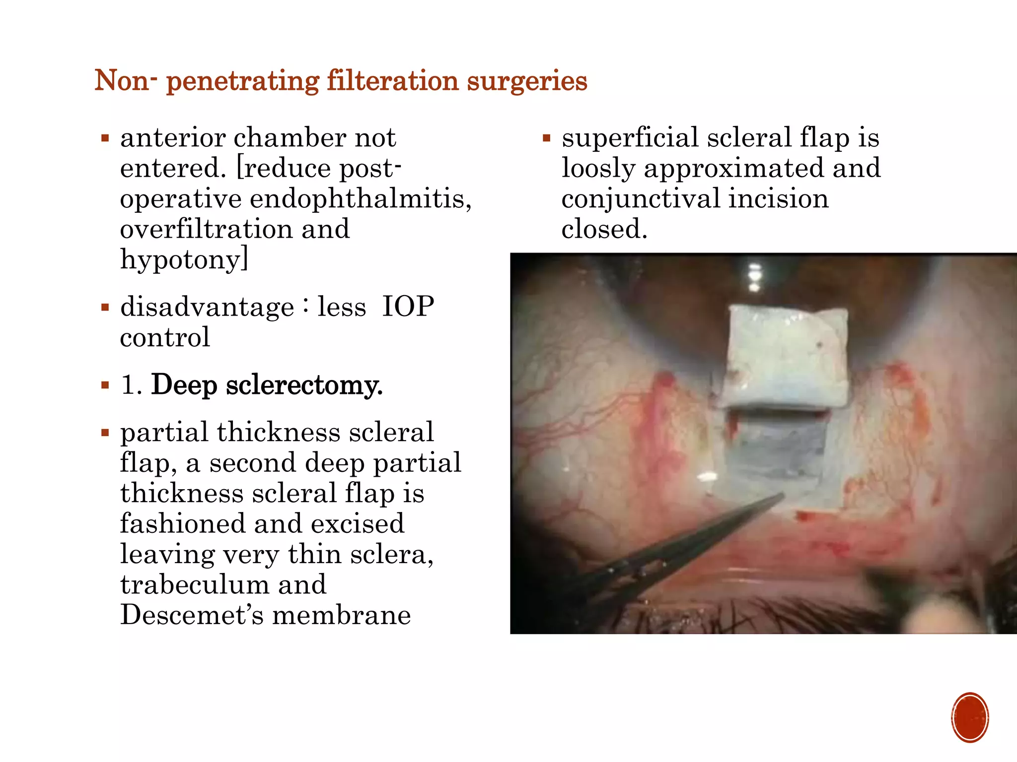 Non- penetrating filteration surgeries
 anterior chamber not
entered. [reduce post-
operative endophthalmitis,
overfiltration and
hypotony]
 disadvantage : less IOP
control
 1. Deep sclerectomy.
 partial thickness scleral
flap, a second deep partial
thickness scleral flap is
fashioned and excised
leaving very thin sclera,
trabeculum and
Descemet’s membrane
 superficial scleral flap is
loosly approximated and
conjunctival incision
closed.
 2. Viscocanalostomy.
 similar to deep
sclerectomy, except that
after excising the deeper
scleral flap, high viscosity
viscoelastic substance is
injected into the
Schlemm's canal with a
special cannula.
 