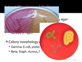  Colony Morphology on Mc Conkey agar:
 LF : E.coli, Klebsiella, Enterobacter
 NLF: Proteus mirabilis, Pseudomonas, Staph.
Aureus, S. Typhi
 Colony morphology on Blood agar:
 Gamma: E.coli, proteus mirabilis
 Beta: Staph. Aureus, Pseudomonas
 