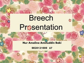 Nur Amalina Aminuddin Baki
0820121000 67
 