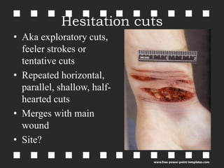 Mellss yr 4 forensic defence, hesitation, self inflicted and fabricated  injuries | PPT