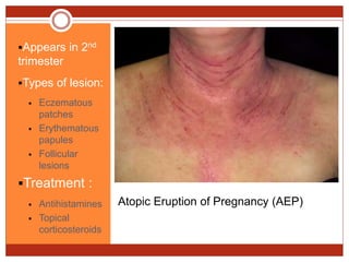 Mellss yr5 obg d iseases in pregnancy hematology, immunology,rs, git | PPTX