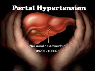 Nur Amalina Aminuddin
082012100067
Portal Hypertension
 