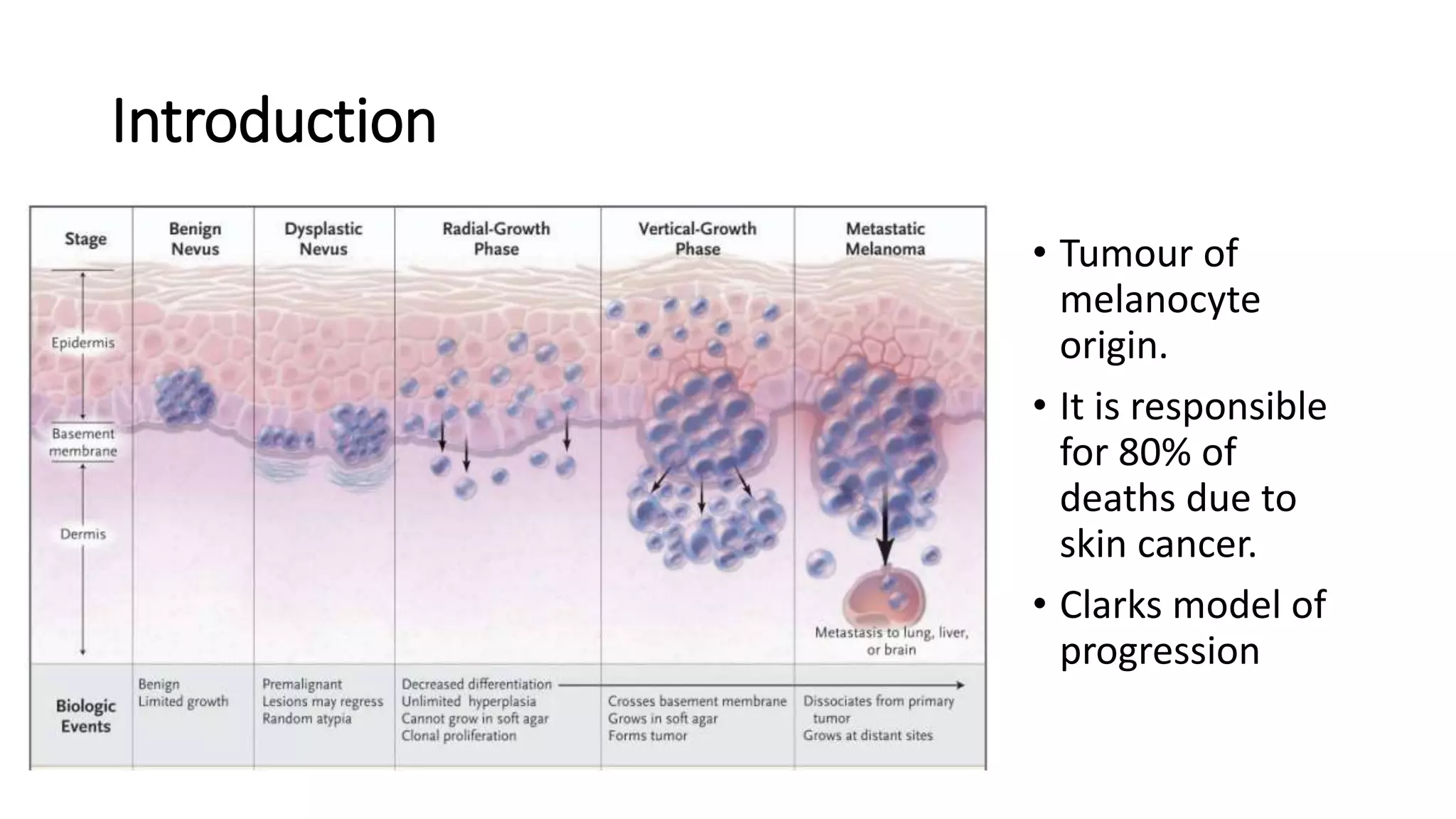 Management of malignant melanoma | PPTX