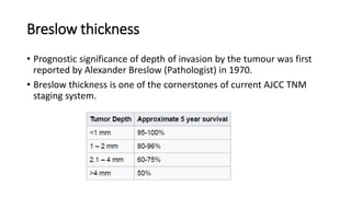 Management of malignant melanoma | PPTX
