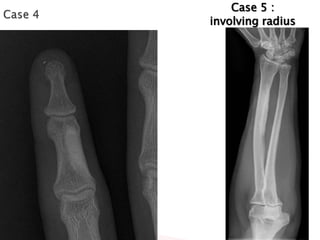 Case 5 :
involving radius

 
