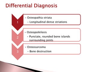 • Osteopathia striata

1

• Longitudinal dense striations

• Osteopoikilosis

2

• Punctate, rounded bone islands
surrounding joints
• Osteosarcoma

3

• Bone destruction

 