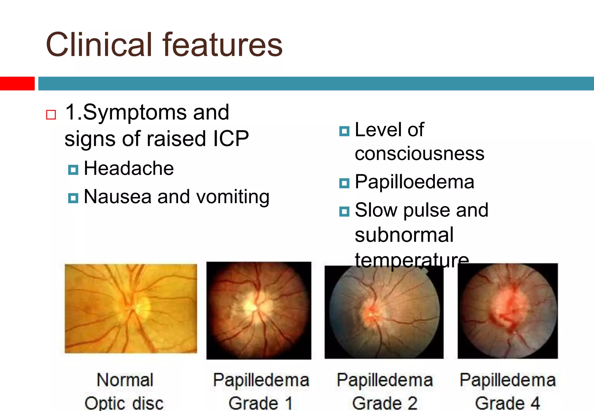 Clinical features
 1.Symptoms and
signs of raised ICP
 Headache
 Nausea and vomiting
 Level of
consciousness
 Papilloedema
 Slow pulse and
subnormal
temperature
 