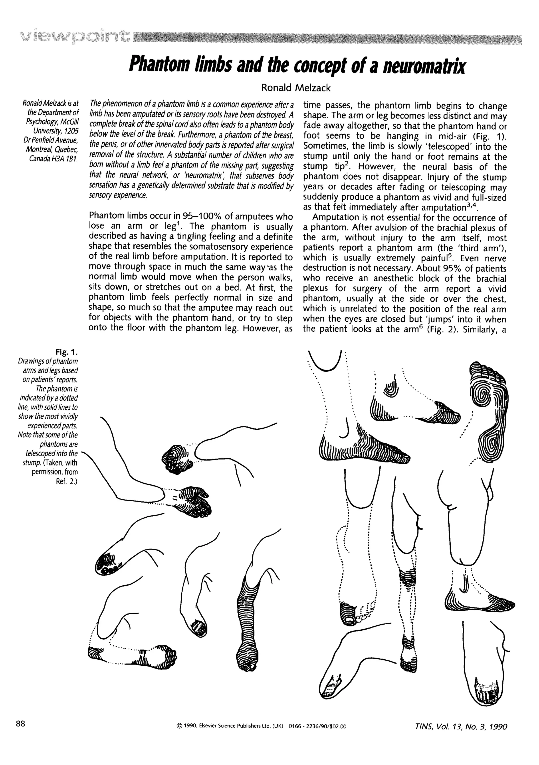 Curated visual reference: Visual Reference: Melzack 1990