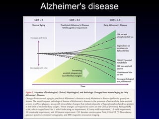 Alzheimer's disease 