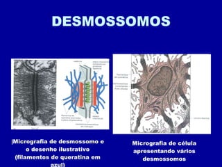 DESMOSSOMOS |Micrografia de desmossomo e o desenho ilustrativo (filamentos de queratina em azul) Micrografia de célula apresentando vários desmossomos 
