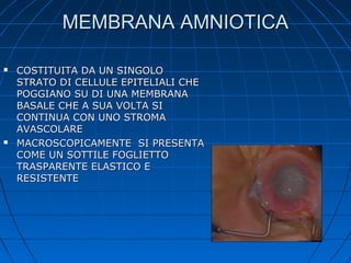 MEMBRANA AMNIOTICA




COSTITUITA DA UN SINGOLO
STRATO DI CELLULE EPITELIALI CHE
POGGIANO SU DI UNA MEMBRANA
BASALE CHE A SUA VOLTA SI
CONTINUA CON UNO STROMA
AVASCOLARE
MACROSCOPICAMENTE SI PRESENTA
COME UN SOTTILE FOGLIETTO
TRASPARENTE ELASTICO E
RESISTENTE

 