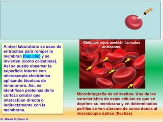 ¿Cómo es la
superficie interna
de la membrana?
Glóbulos rojos también llamados
eritrocitos.
Ya vimos la estructura molecular de la membrana celular. Está formada
por dos monocapas de fosfolípidos anfipáticos por lo que se denomina
bicapa lipídica. Entre los fosfolípidos se encuentran proteínas con
varias disposiciones y función. Pero esta estructura de la membrana
necesita ayuda, entonces los investigadores usaron como modelo a los
eritrocitos para ver qué pasa, tanto en la superficie interna o citosólica,
como en la externa de la membrana.
A nivel laboratorio se usan de
eritrocitos para romper la
membran (haz clic) y se
invierten (como calcetines).
Así se puede observar la
superficie interna con
microscopía electrónica
aplicando técnicas de
inmuno-oro. Así, se
identifican proteínas de la
corteza celular que
interactúan directa o
indirectamente con la
membrana.
Microfotografía de eritrocitos. Una de las
característica de estas células es que se
deprime su membrana y en determinados
perfiles se ven claramente como donas al
microscopio óptico (flechas)
Dr. Misael R. Oliver G.
 