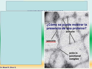 Técnica de inmuno-oro y microscopía electrónica de
transmisión aplicadas a la superficie interna de la
membrana de eritrocitos
Dr. Misael R. Oliver G.
Los anticuerpos son proteínas del sistema
inmune que reconocen y atacan a proteínas
extrañas al organismo de un individuo
(humano o animal). Como reconocen
proteínas los investigadores los usan para
identificar proteínas que estén estudiando.
Al unirle partículas de oro a los anticuerpos,
estos se pueden observar al microscopio
electrónico, por lo que al reconocer el
anticuerpo con la partícula de oro a la
proteína que buscamos lo podemos ver al
microscopio electrónico como zonas gris
oscuro. Haz clic. En esta imagen se
señalan los dímeros alargados que es la
espectrina. ¿Recuerdas hasta qué
dimensión de medida se puede observar a
través del microscopio electrónico? Si no te
acuerdas revísalo en las diapositivas del
tema de introducción.
¿Cómo se puede mostrar la
presencia de una proteína?
 