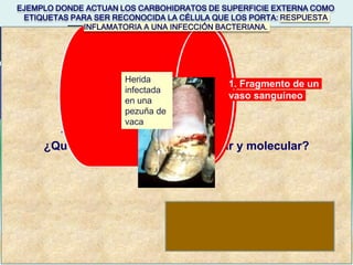 3. Neutrófilos circulando
(Estos son parte de los linfocitos)
5. Proteína de
membrana del
endotelio
llamada
Lectina que
reconoce al
azúcar del
neutrófilo que
va circulando y
lo detiene.
2. Células endoteliales
4. Azúcar
específico del
neutrófilos para
ser reconocido
por proteínas del
endotelio
Sitio de infección
Dr. Misael R. Oliver G.
Bacterias
6. Salida del neutrófilo al ser
reconocido por lectina cerca
del sitio de infección
2. Células
Endoteliales. Revisten
la superficie interna de
los vasos sanguíneos.
Neutrófilo
¿Qué está pasando a nivel celular y molecular?
Los neutrófilos eliminan a las bacterias.
1. Fragmento de un
vaso sanguíneo
EJEMPLO DONDE ACTUAN LOS CARBOHIDRATOS DE SUPERFICIE EXTERNA COMO
ETIQUETAS PARA SER RECONOCIDA LA CÉLULA QUE LOS PORTA: RESPUESTA
INFLAMATORIA A UNA INFECCIÓN BACTERIANA.
Herida
infectada
en una
pezuña de
vaca
 