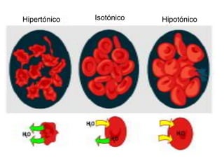Hipertónico   Isotónico   Hipotónico
 