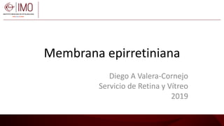 Membrana epirretiniana
Diego A Valera-Cornejo
Servicio de Retina y Vítreo
2019
 