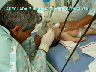 ADECUADA E  INMEDIATA  ATENCION AL R.N. 