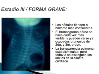 COMPOSICION DEL SURFACTANTE