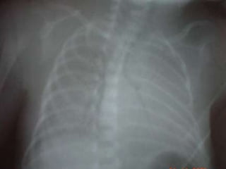 ETIOLOGIA  --  PATOGENIA