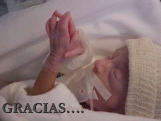 El broncograma aéreo es muy discreto, no sobrepasa la imagen cardiotimica. 