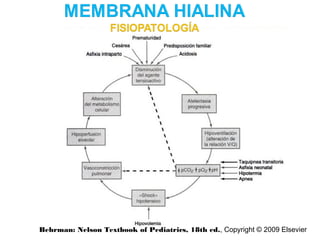 Behrman: Nelson Textbook of Pediatrics, 18th ed., Copyright © 2009 Elsevier
 