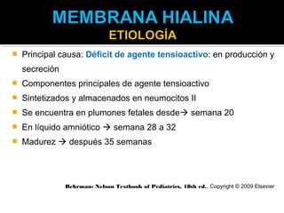    Principal causa: Déficit de agente tensioactivo: en producción y
    secreción
   Componentes principales de agente tensioactivo
   Sintetizados y almacenados en neumocitos II
   Se encuentra en plumones fetales desde semana 20
   En líquido amniótico  semana 28 a 32
   Madurez  después 35 semanas




                Behrman: Nelson Textbook of Pediatrics, 18th ed., Copyright © 2009 Elsevier
 