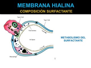METABOLISMO DEL
 SURFACTANTE
 