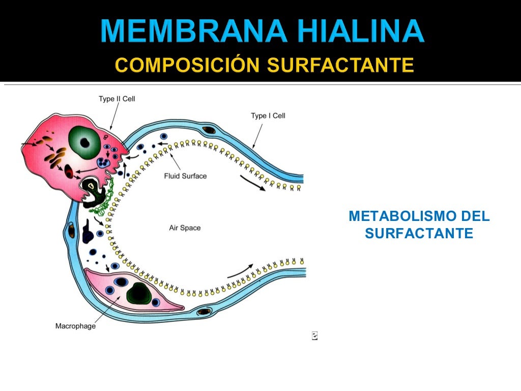 Enfermedad de la Membrana hialina