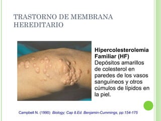 TRASTORNO DE MEMBRANA
HEREDITARIO
Hipercolesterolemia
Familiar (HF)
Depósitos amarillos
de colesterol en
paredes de los vasos
sanguíneos y otros
cúmulos de lípidos en
la piel.
Campbell N. (1990) Biology; Cap 8.Ed. Benjamin-Cummings, pp:154-175
 