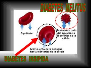 DIABETES  INSIPIDA DIABETES  MELITUS 