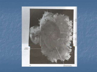 Membranas fetales y placenta  2016  