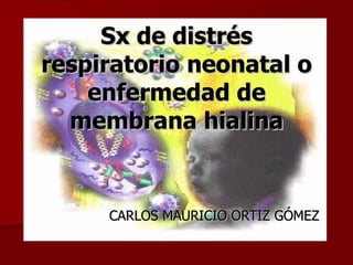 Sx de distrés respiratorio neonatal o enfermedad de membrana hialina CARLOS MAURICIO ORTIZ GÓMEZ 
