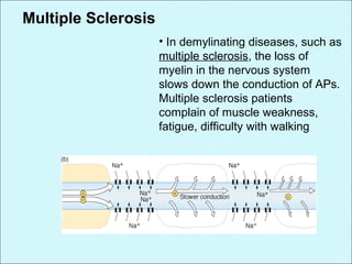 Multiple Sclerosis
• In demylinating diseases, such as
multiple sclerosis, the loss of
myelin in the nervous system
slows down the conduction of APs.
Multiple sclerosis patients
complain of muscle weakness,
fatigue, difficulty with walking
 