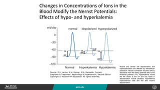 psm.edu
Changes in Concentrations of Ions in the
Blood Modify the Nernst Potentials:
Effects of hypo- and hyperkalemia
Muscle and cardiac cell depolarization and
hyperpolarization are affected by extracellular
potassium. Muscle contraction requires cells to
depolarize from the resting potential (RP) to the
threshold potential (TP). Hyperkalemia moves
the RP closer to the TP and can result in
depolarization muscle paralysis. Hypokalemia
hyperpolarizes cells and this also impairs
depolarization.
 