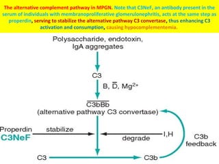 The alternative complement pathway in MPGN. Note that C3NeF, an antibody present in the
serum of individuals with membranoproliferative glomerulonephritis, acts at the same step as
properdin, serving to stabilize the alternative pathway C3 convertase, thus enhancing C3
activation and consumption, causing hypocomplementemia.
 