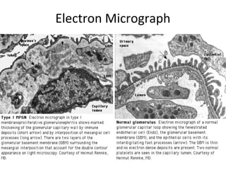 Electron Micrograph
 