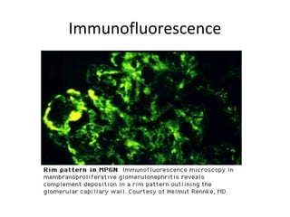 Immunofluorescence
 